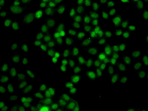 Cell Biology Antibodies 11 Anti-PIP5K1A Antibody CAB7941