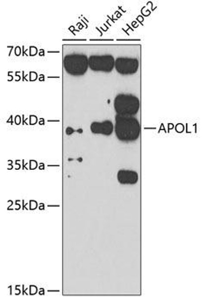 Metabolism Antibodies 2 Anti-APOL1 Antibody CAB7943