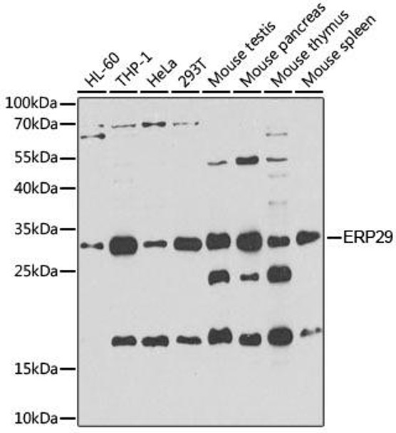 KO Validated Antibodies 1 Anti-ERP29 Antibody CAB7959KO Validated