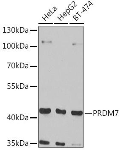 Cell Biology Antibodies 11 Anti-PRDM7 Antibody CAB7961