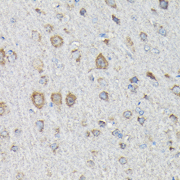 Metabolism Antibodies 2 Anti-MTHFD1L Antibody CAB7969