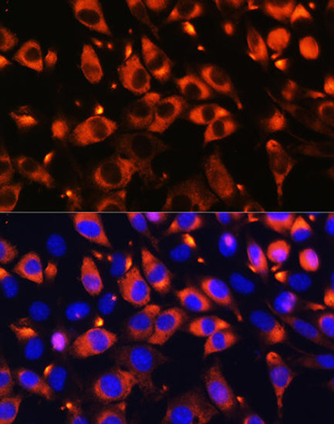 Cell Biology Antibodies 11 Anti-B9D1 Antibody CAB7973