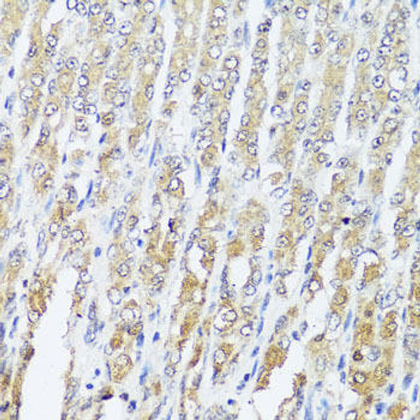 Cell Biology Antibodies 11 Anti-MCCC2 Antibody CAB7990