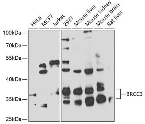 Cell Cycle Antibodies 2 Anti-BRCC3 Antibody CAB7995