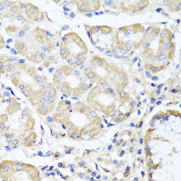 Signal Transduction Antibodies 3 Anti-OPA3 Antibody CAB7997