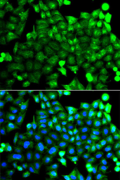 Cell Biology Antibodies 11 Anti-Neurocalcin-delta Antibody CAB8000