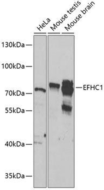 Cell Biology Antibodies 11 Anti-EFHC1 Antibody CAB8002