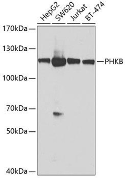 Metabolism Antibodies 2 Anti-PHKB Antibody CAB8015