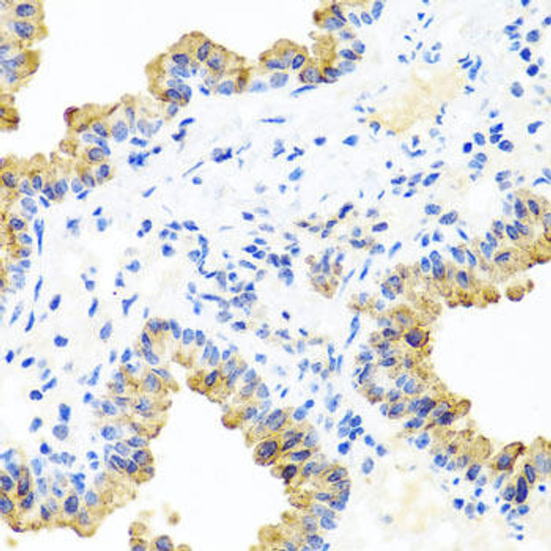 Cell Biology Antibodies 11 Anti-PIP4K2B Antibody CAB8016