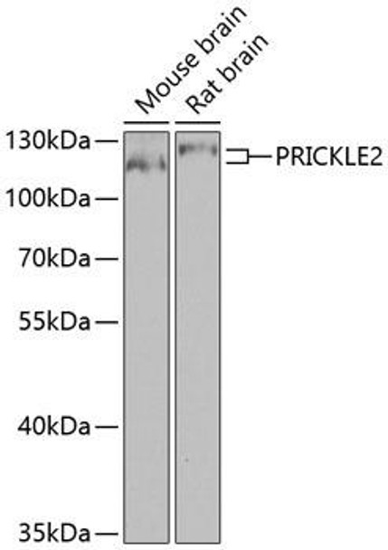 Cell Biology Antibodies 11 Anti-PRICKLE2 Antibody CAB8023
