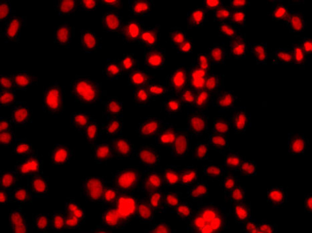 Cell Biology Antibodies 11 Anti-PRICKLE2 Antibody CAB8023