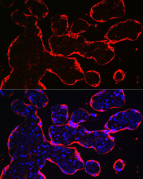 Metabolism Antibodies 2 Anti-HSD3B1 Antibody CAB8035