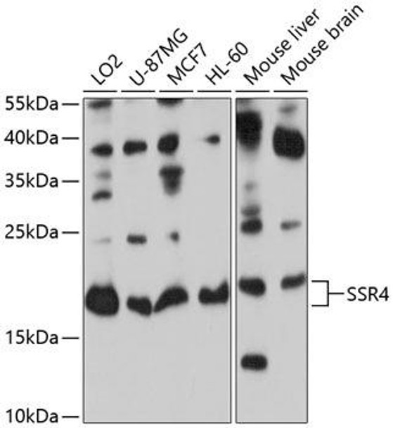 Cell Biology Antibodies 11 Anti-SSR4 Antibody CAB8037