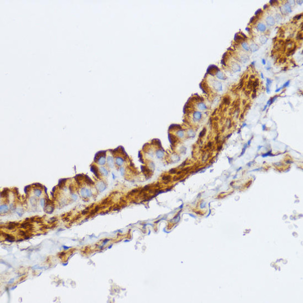 Cell Biology Antibodies 11 Anti-MYLK Antibody CAB8041