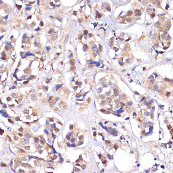 Cell Death Antibodies 2 Anti-STK4 Antibody CAB8043