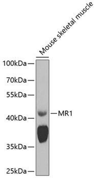 Immunology Antibodies 2 Anti-MR1 Antibody CAB8051