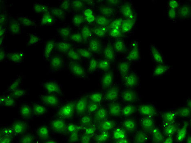 Epigenetics and Nuclear Signaling Antibodies 4 Anti-MBNL1 Antibody CAB8054