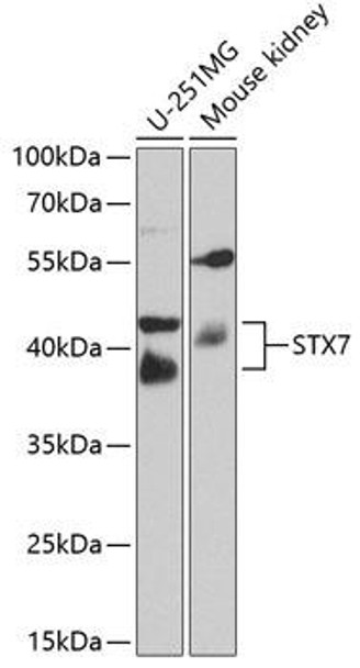 Cell Biology Antibodies 11 Anti-Syntaxin-7 Antibody CAB8057