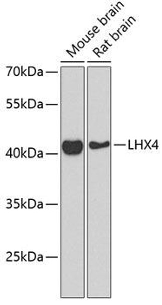 Epigenetics and Nuclear Signaling Antibodies 4 Anti-LHX4 Antibody CAB8072