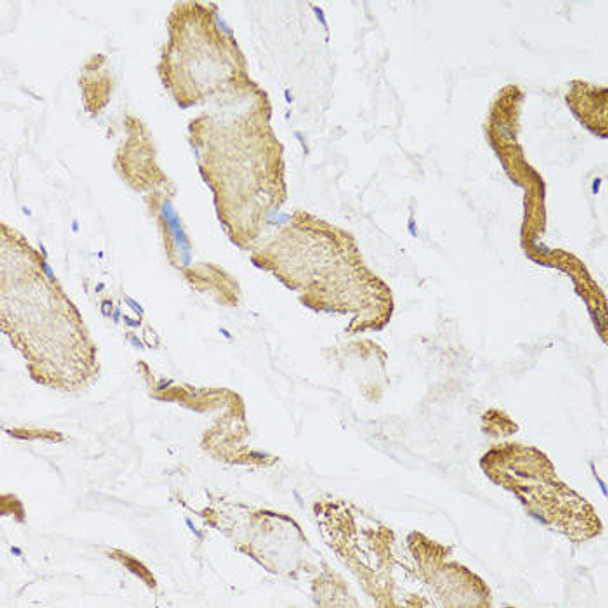 Cell Biology Antibodies 11 Anti-CKMT2 Antibody CAB8088