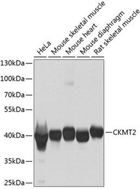 Cell Biology Antibodies 11 Anti-CKMT2 Antibody CAB8088