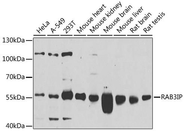 Cell Biology Antibodies 11 Anti-RAB3IP Antibody CAB8094