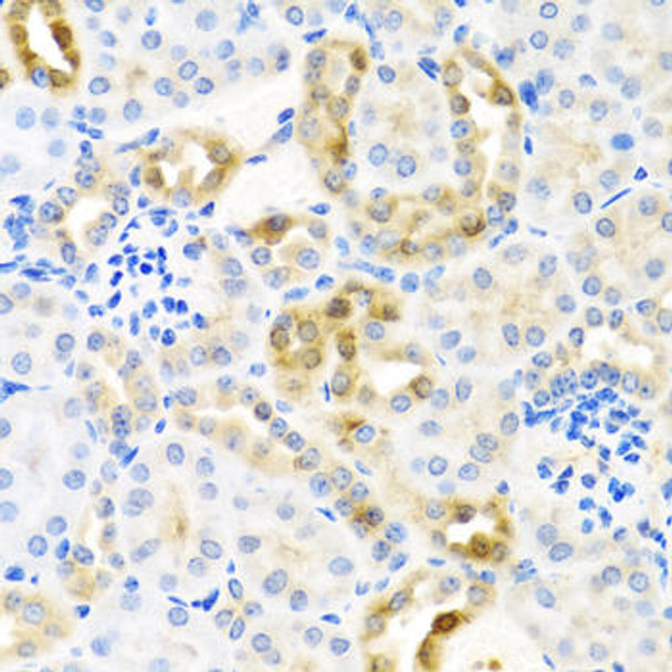 Cell Biology Antibodies 11 Anti-Cystatin-S Antibody CAB8114
