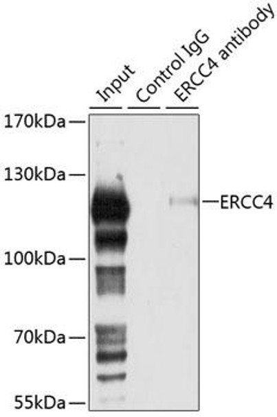 Epigenetics and Nuclear Signaling Antibodies 4 Anti-ERCC4 Antibody CAB8119