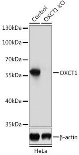 KO Validated Antibodies 1 Anti-OXCT1 Antibody CAB8139KO Validated