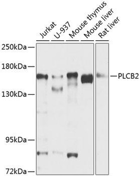Metabolism Antibodies 3 Anti-PLCB2 Antibody CAB8141