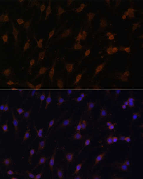 KO Validated Antibodies 1 Anti-POR Antibody CAB8142KO Validated