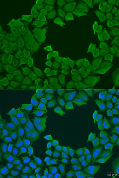 Cell Biology Antibodies 11 Anti-STXBP3 Antibody CAB8153