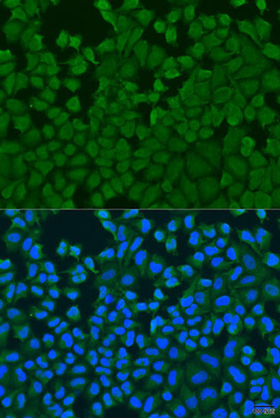 Cell Biology Antibodies 12 Anti-IL27RA Antibody CAB8176