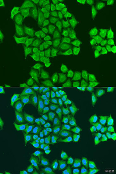 Cell Biology Antibodies 12 Anti-Synaptotagmin-11 Antibody CAB8198