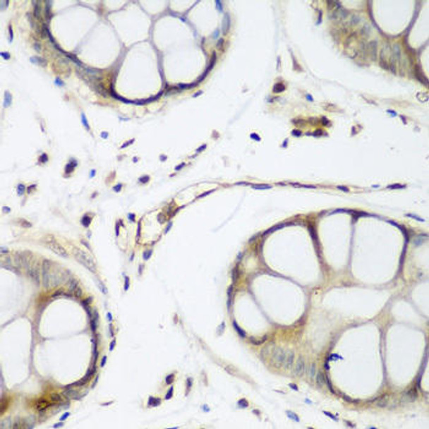 Epigenetics and Nuclear Signaling Antibodies 4 Anti-TAZ Antibody CAB8202