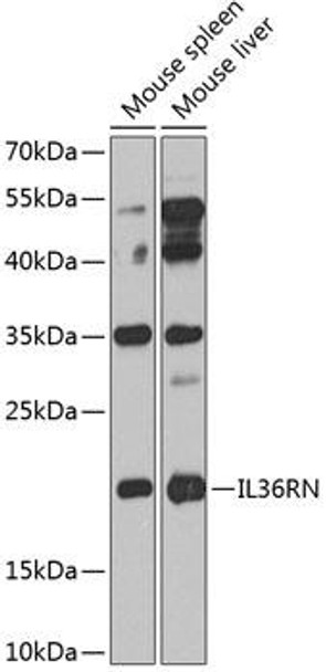 Immunology Antibodies 3 Anti-IL36RN Antibody CAB8205