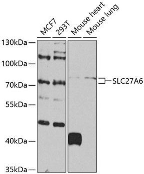 Metabolism Antibodies 3 Anti-SLC27A6 Antibody CAB8208