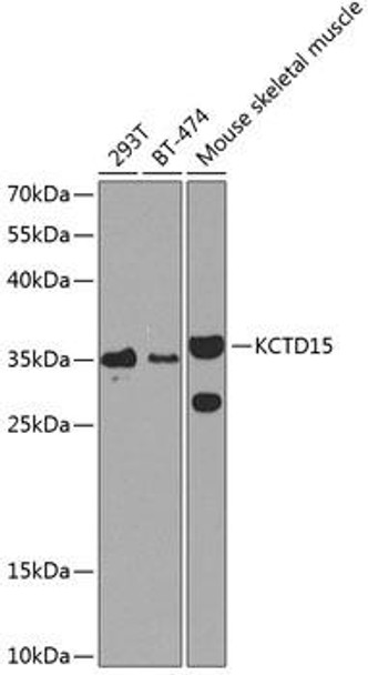 Cell Biology Antibodies 12 Anti-KCTD15 Antibody CAB8256