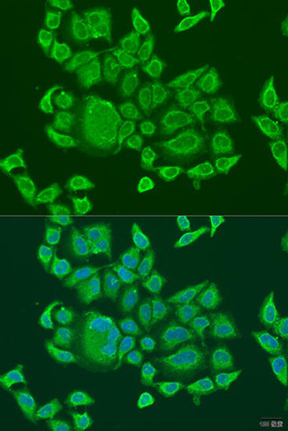 Immunology Antibodies 3 Anti-DHX58 Antibody CAB8257