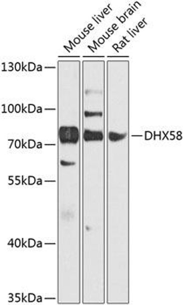Immunology Antibodies 3 Anti-DHX58 Antibody CAB8257