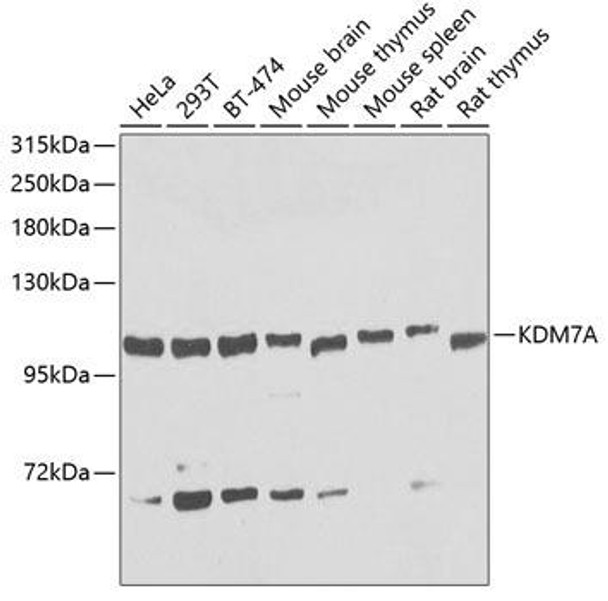 Cell Biology Antibodies 12 Anti-KDM7A Antibody CAB8266