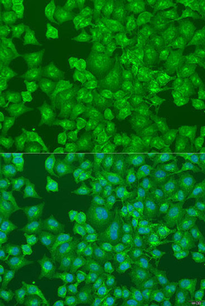 Epigenetics and Nuclear Signaling Antibodies 4 Anti-DCP2 Antibody CAB8282