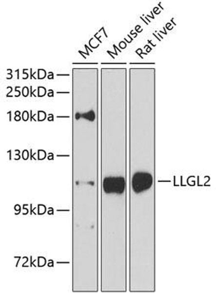 Cell Biology Antibodies 12 Anti-LLGL2 Antibody CAB8284