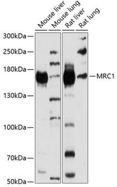Cell Biology Antibodies 12 Anti-MRC1 Antibody CAB8301