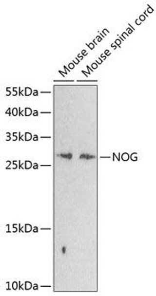 Cell Biology Antibodies 12 Anti-Noggin Antibody CAB8305