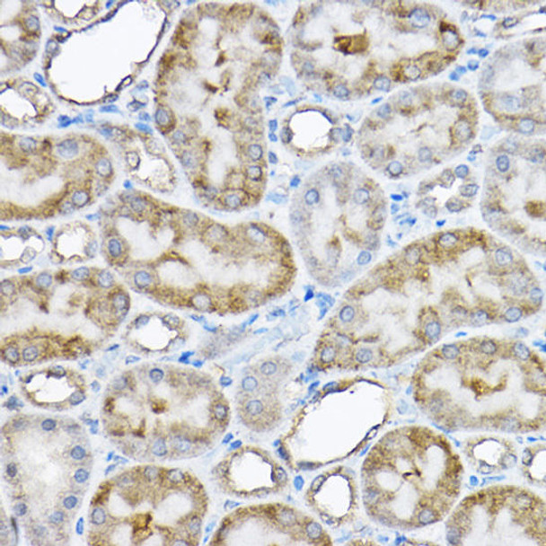 Cell Biology Antibodies 12 Anti-GRPEL2 Antibody CAB8339