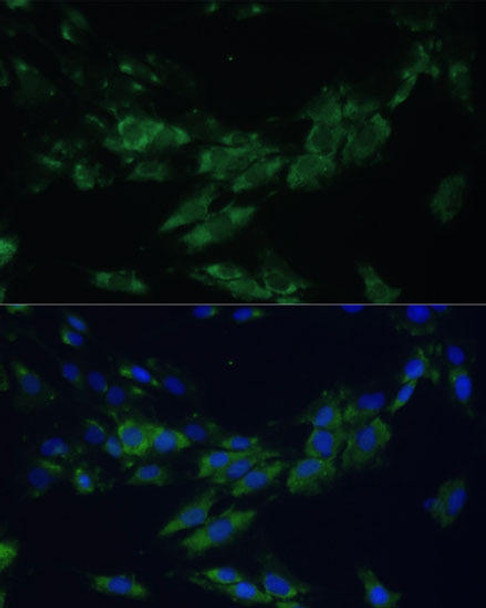 Cell Biology Antibodies 12 Anti-EPHA4 Antibody CAB8346