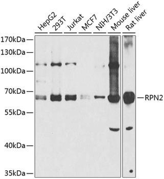 Cell Biology Antibodies 12 Anti-RPN2 Antibody CAB8352