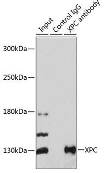 Epigenetics and Nuclear Signaling Antibodies 4 Anti-XPC Antibody CAB8354