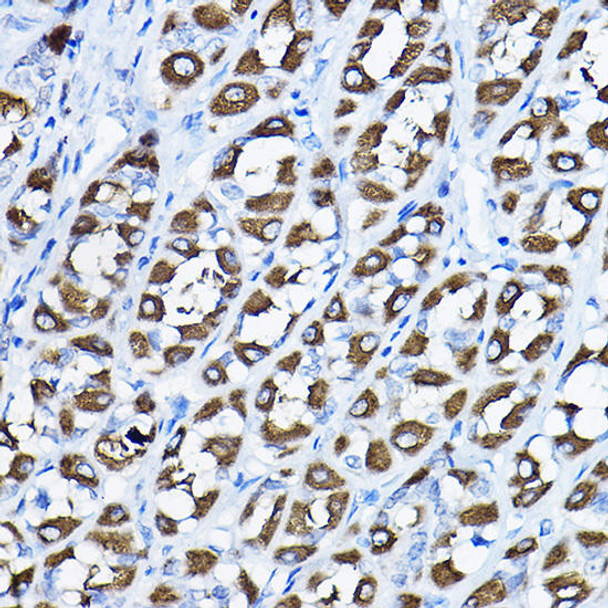 Cell Biology Antibodies 12 Anti-PGLS Antibody CAB8366